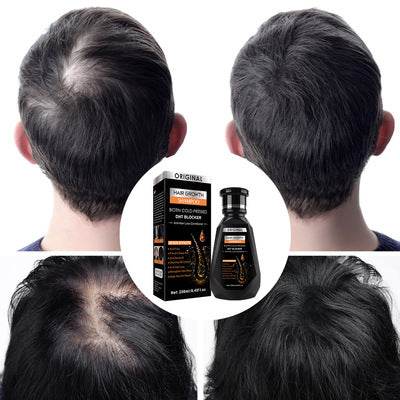 anti hair loss hair growth shampoo (250ml) anti hair loss hair growth shampoo (250ml)