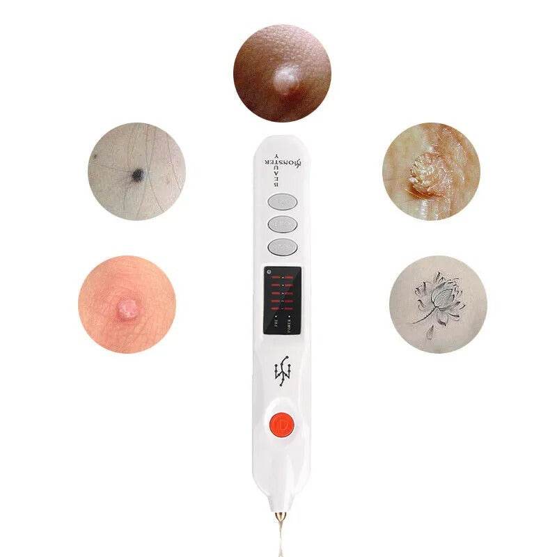 fibroblast plasma pen (mole remover) fibroblast plasma pen (mole remover)