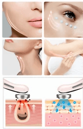 Photon Skin Beautifier Photon Skin Beautifier - Image 2